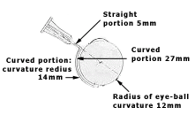 Diagram of the modified sub-Tenon's cannula: curved portion (radius 14mm) overlaid on the eyeball's curve (radius 12mm), with the 5mm straight portion branching off.